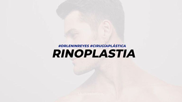 Rinoplastia