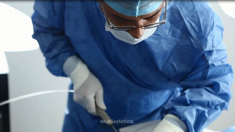 Lipoescultura, una cirugía adaptada a lo que busca el paciente