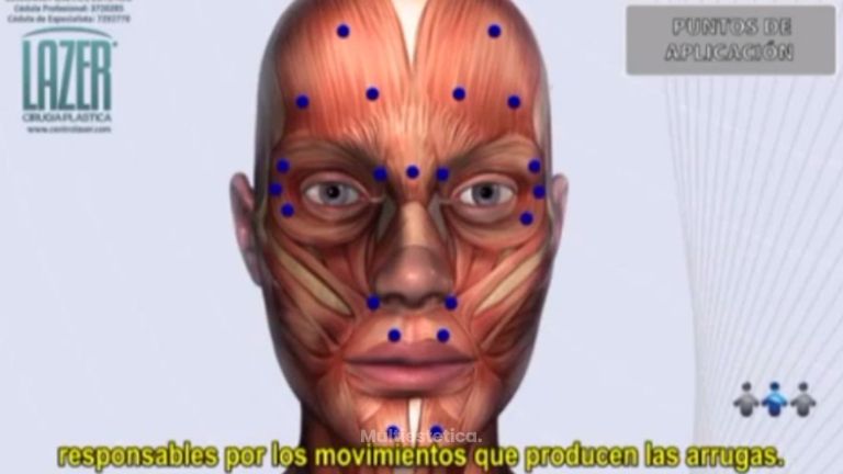 La mejor forma de acabar con las arrugas