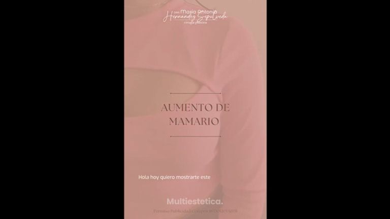 Aumento de busto - Dra. Maria Antonia Hernández Sepúlveda