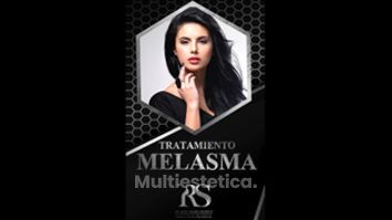 Melasma - Unidad de Medicina Estética de Querétaro