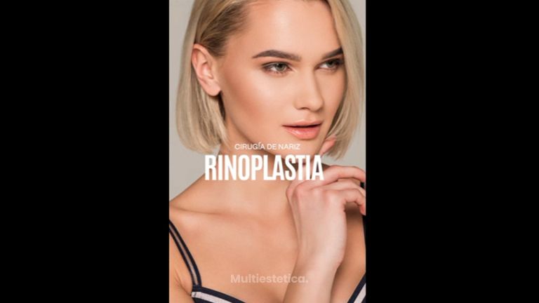 Rinoplastia - Dr. Gerardo Rayón Nieva
