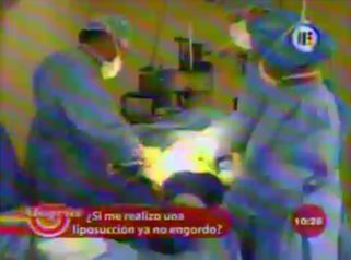 Las mejores respuestas sobre cirugía plástica