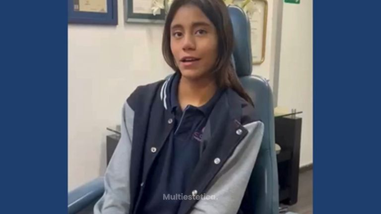Testimonio Rinoplastia - Dr. Sergio Guillermo Ramírez Ledesma