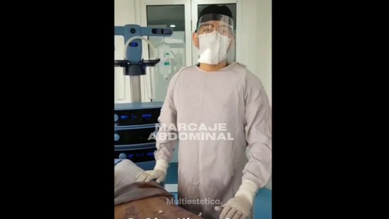 Abdominoplastia - Dr. César Vázquez