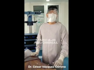 Abdominoplastia - Dr. César Vázquez