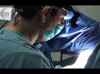 Ninfoplastia