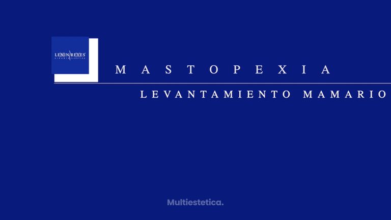Mastopexia - Dr. Lenin Alfonso Reyes Ibarra