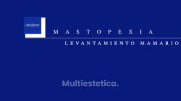 Mastopexia - Dr. Lenin Alfonso Reyes Ibarra