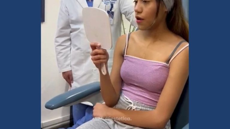 Testimonio Rinoplastia - Dr. Sergio Guillermo Ramírez Ledesma