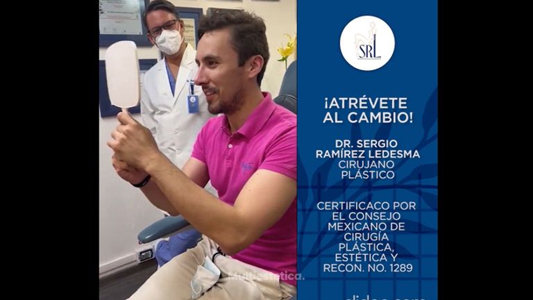 Rinoplastia - Dr. Sergio Guillermo Ramírez Ledesma