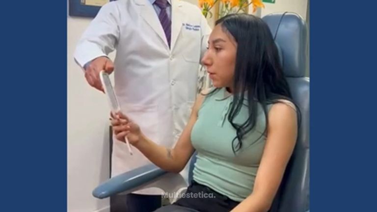 Testimonio Rinoplastia - Dr. Sergio Guillermo Ramírez Ledesma