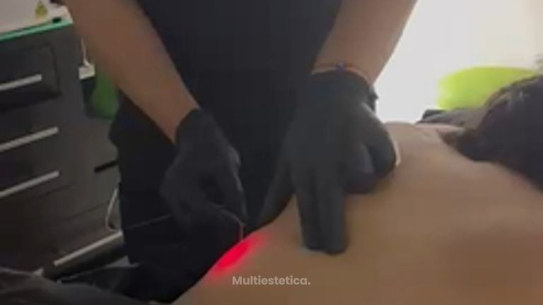 Eliminar grasa localizada - SkinGama by Dr. Jorge Juan Herrera