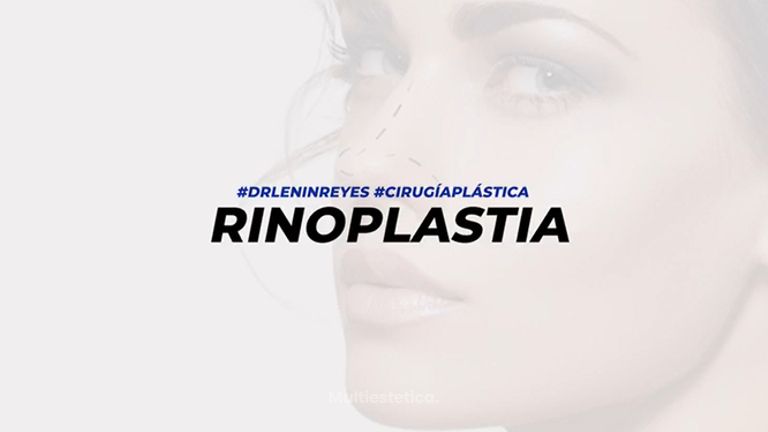 Rinoplastia - Dr. Lenin Alfonso Reyes Ibarra