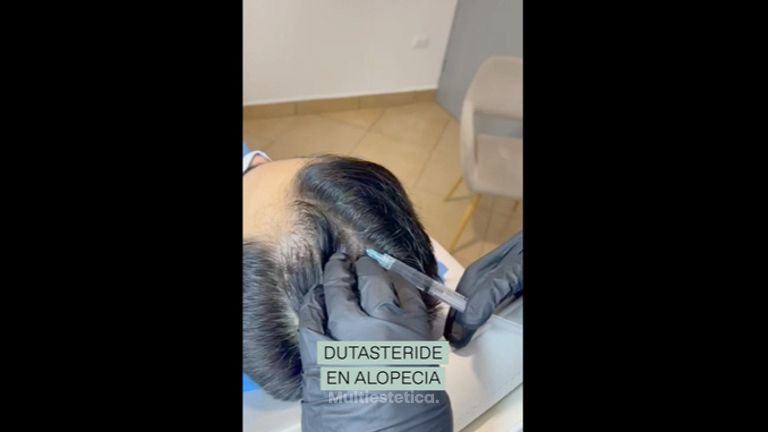 Alopecia - Merlos & Caraza