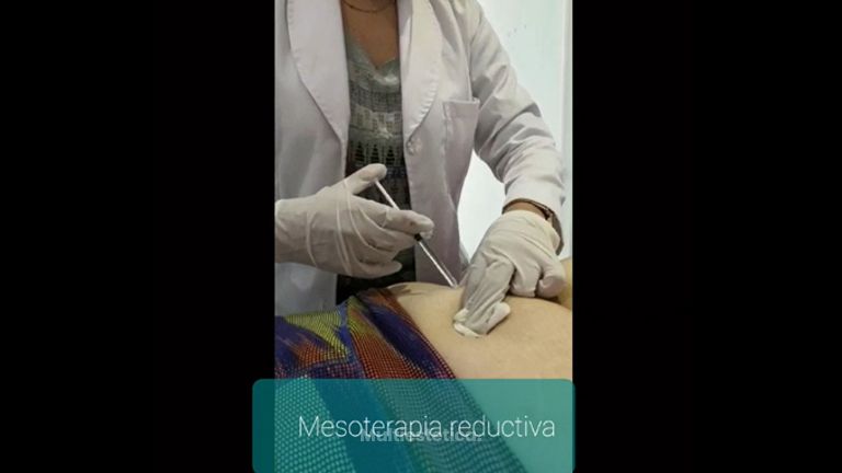 Mesoterapia - Qclínik by Dra. Lorena Padrón