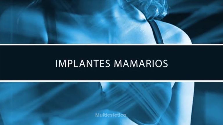 Implantes mamarios
