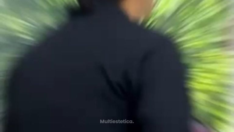 Toxinna Botulínica - SkinGama by Dr. Jorge Juan Herrera