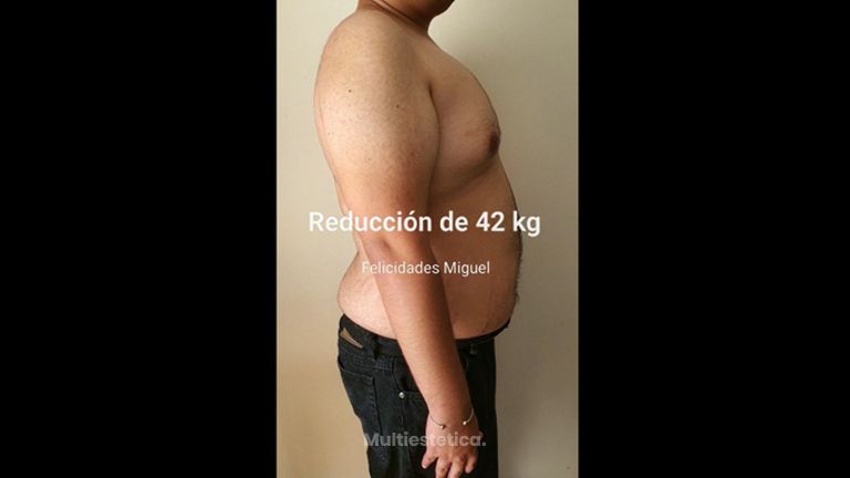 Dieta