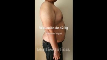 Dieta