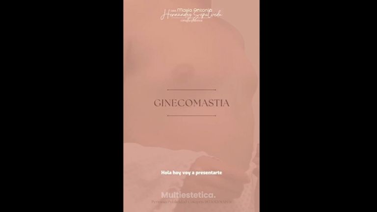 Ginecomastia - Dra. Maria Antonia Hernández Sepúlveda