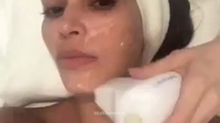 EndyMed 3DEEP – Radiofrecuencia - Clinica Dermatológica y Cirugía Estética Puebla