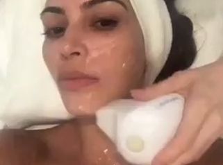 EndyMed 3DEEP – Radiofrecuencia - Clinica Dermatológica y Cirugía Estética Puebla