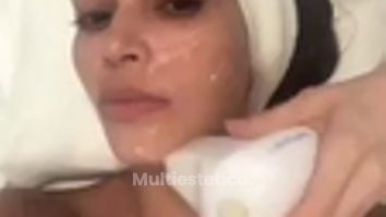 EndyMed 3DEEP – Radiofrecuencia - Clinica Dermatológica y Cirugía Estética Puebla