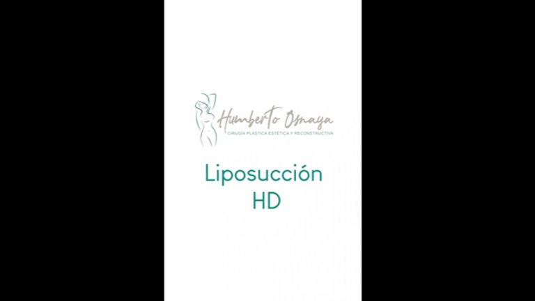 Liposucción - Dr. Humberto Osnaya Moreno
