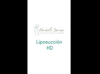 Liposucción - Dr. Humberto Osnaya Moreno