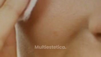 Hifu - Moskalia