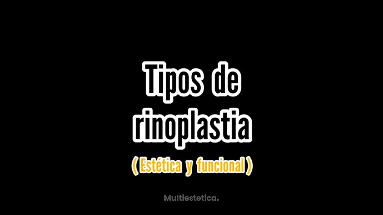 Tipos de Rinoplastia - Dr. Xavier Sánchez García