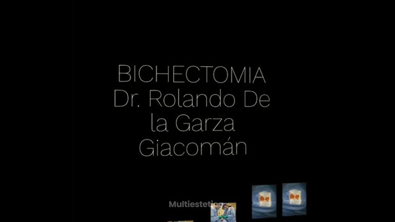 Bolsas de bichat - Fasent. Dr Rolando de la Garza Giacomán