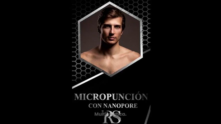 Micropunción - Dr. Raúl Sierra Franco