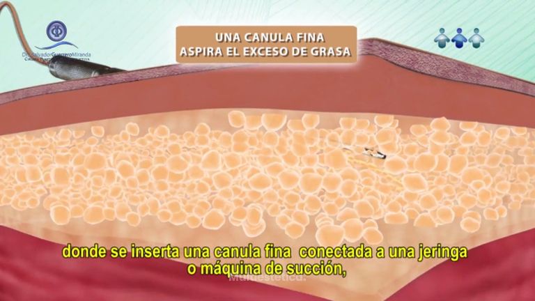 La mejor forma de remodelar tu silueta