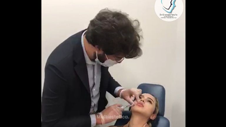 Aumento de labios - Dr. Giuseppe Tanzillo Greco