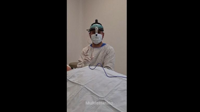 Blefaroplastia - Dr. Iván Torres Baltazar