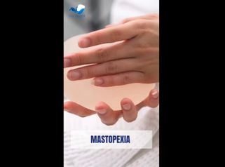 Mastopexia - Dr. Mario Alonso Flores Saldivar