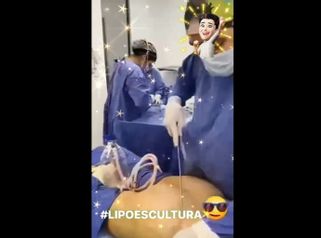 Lipoescultura - Dr Daniel Ponce Franco