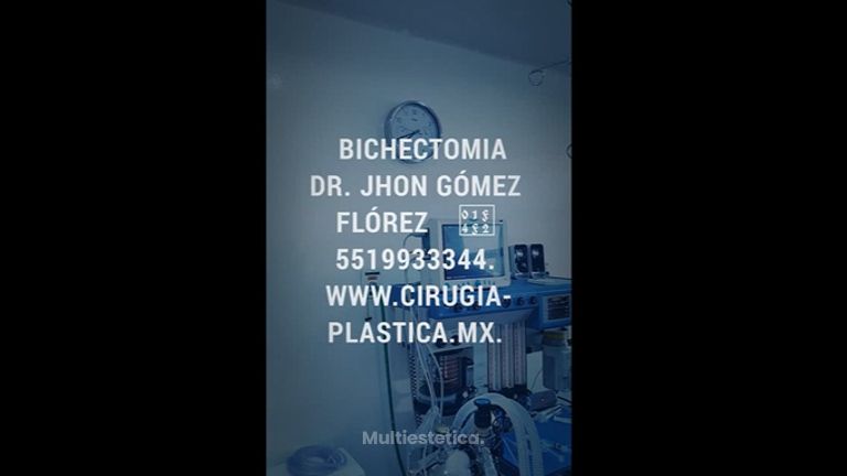 Dr. Jhon Gómez Cirujano Plástico - Bichectomia