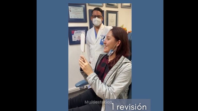 Rinoplastia - Dr. Sergio Guillermo Ramírez Ledesma