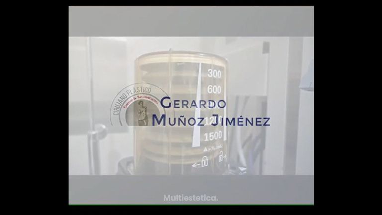 Aumento de busto - Dr. Gerardo Muñoz Jiménez