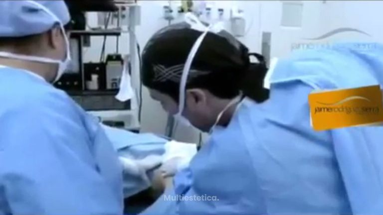 Embellece tu cuerpo con la liposucción