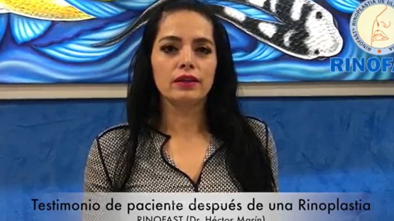Testimonio rinoplastia