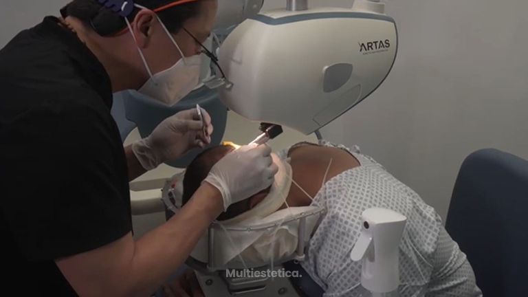Trasplante de cabello - Dr. Alejandro Méndez Sashida