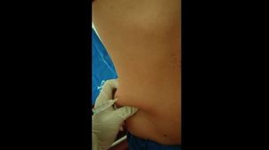 Mesoterapia Mesoterapia