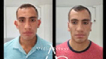 Otoplastia - Dr. Alejandro Cruz Segura