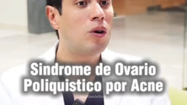 Tratamiento antiacné -SkinGama by Dr. Jorge Juan Herrera