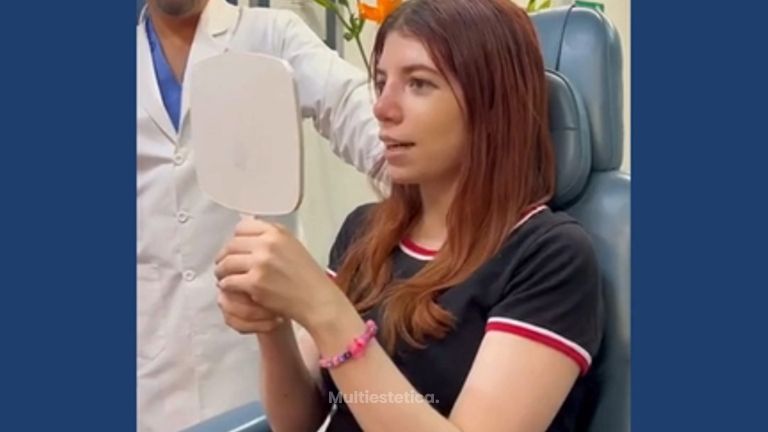 Testimonio Rinoplastia - Dr. Sergio Guillermo Ramírez Ledesma