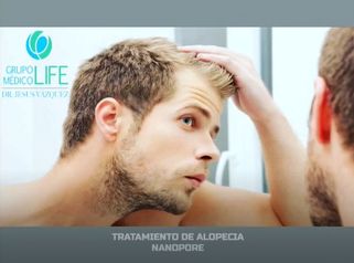 Tratamiento de Alopecia